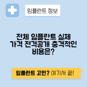 전체 임플란트 가격과 비용 알아보기