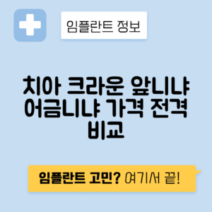 치아 크라운 종류와 가격 안내, 앞니와 어금니 비교