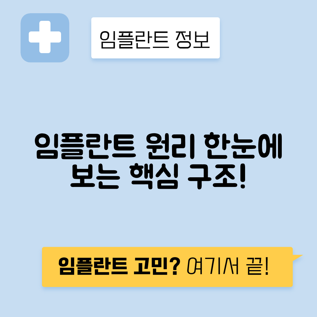 임플란트 식립 원리, 구조 이해하기